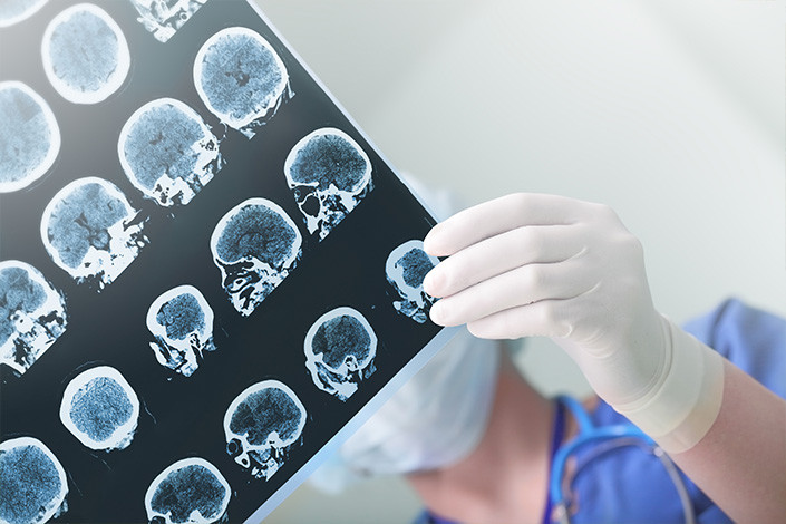 ct-scan-brain.jpg